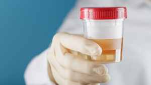 Médico segurando uma amostra de urina com sangue, de luva e roupas de proteção